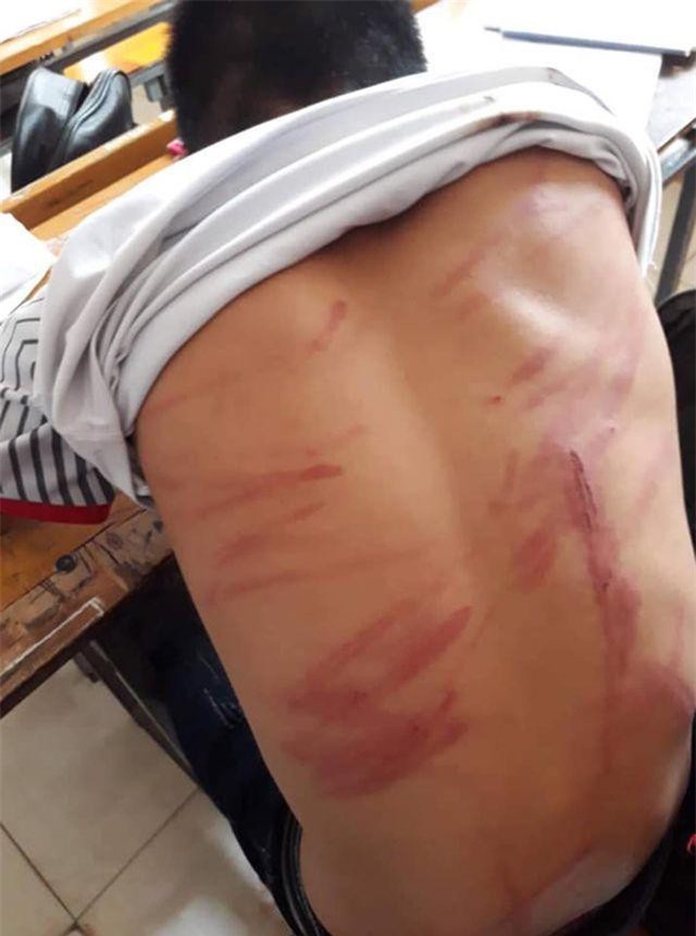 Vụ học sinh lớp 8 bị bố đánh dã man: Trận đòn “cắt” cơn nghiện game?