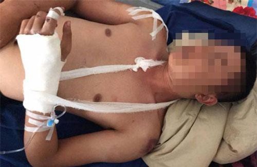 Đắk Lắk: Đi đòi nợ, nam thanh niên bị chém thương tích nặng