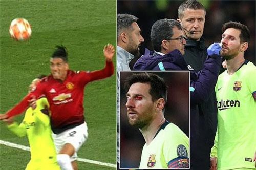 CLIP: Messi đổ máu sau cú va chạm với Smalling