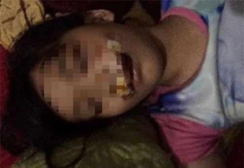 Hà Tĩnh: Chó điên lao vào tấn công 5 người rồi lăn ra chết