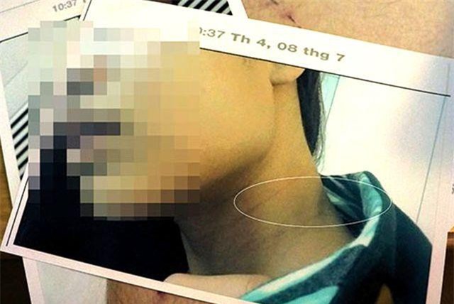 TP.HCM: Truy nã anh rể “hờ” hiếp dâm em vợ