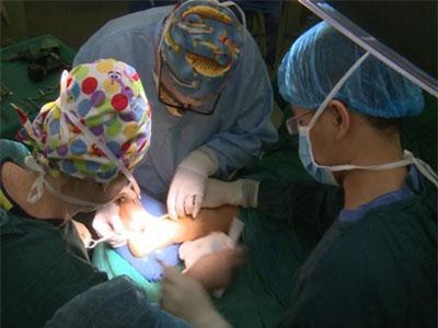 Cơ hội cho các bệnh nhi mắc dị tật cổ bàn chân