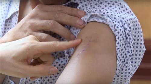 Đắk Lắk: Trưởng công an xã bị đâm 6 nhát khi làm nhiệm vụ