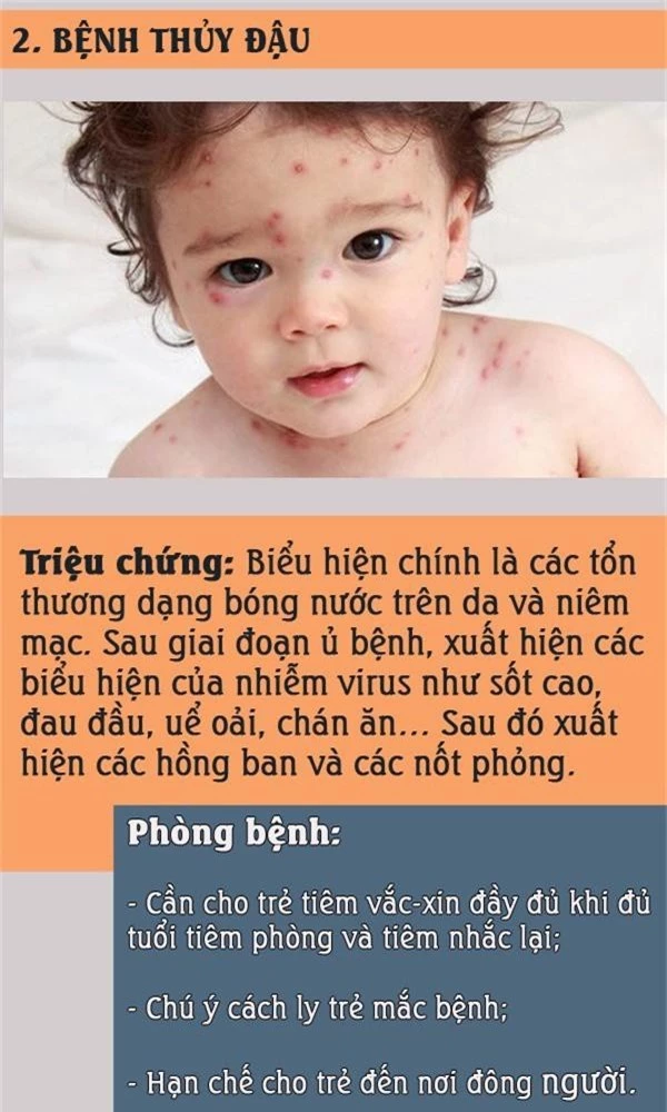 Nắng nóng: Đề phòng những bệnh trẻ thường mắc khi vào hè và cách phòng tránh - Ảnh 2.