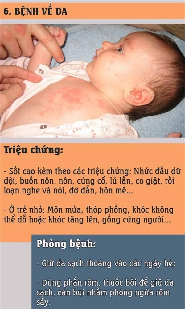 Nắng nóng: Đề phòng những bệnh trẻ thường mắc khi vào hè và cách phòng tránh - Ảnh 6.