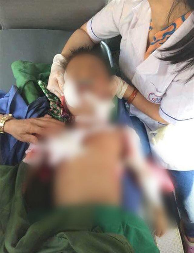  Thái Nguyên: Bé trai 7 tuổi bị chính chó nhà cắn tử vong