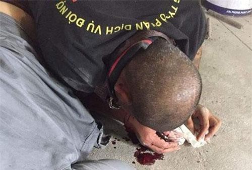 “Con nợ”  đánh đập nhân viên đòi nợ thuê phải nhập viện