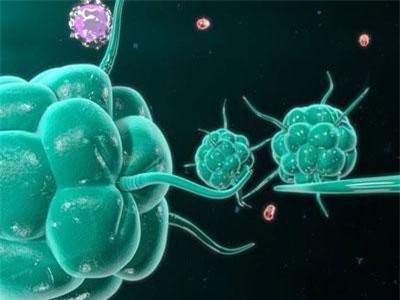 Thừa canxi trong cơ thể có thể dẫn đến ung thư