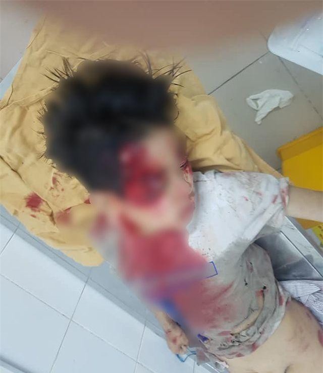 Hà Nội: Nghi án ô tô kéo lê bé trai hơn 100m, Tài xế đến trình diện công an