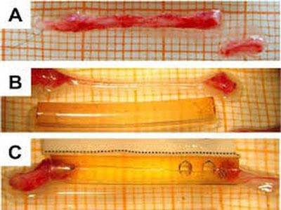 Tái tạo dây thần kinh từ vỏ tôm