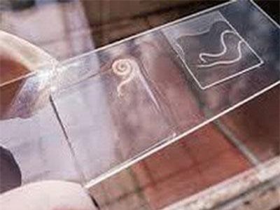 Phòng lây nhiễm bệnh giun kim