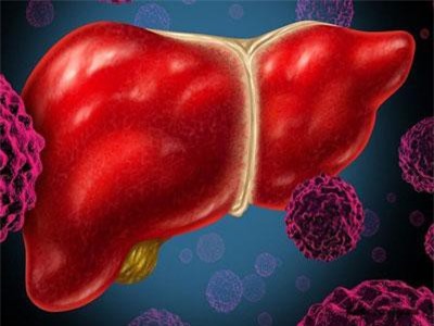 Đây là những trường hợp có nguy cơ mắc bệnh ung thư gan rất cao, số 3 nhiều người mắc phải