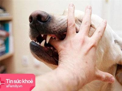 Cảnh báo: Liên tiếp nhiều trường hợp trẻ bị chó nhà nuôi hung hãn tấn công