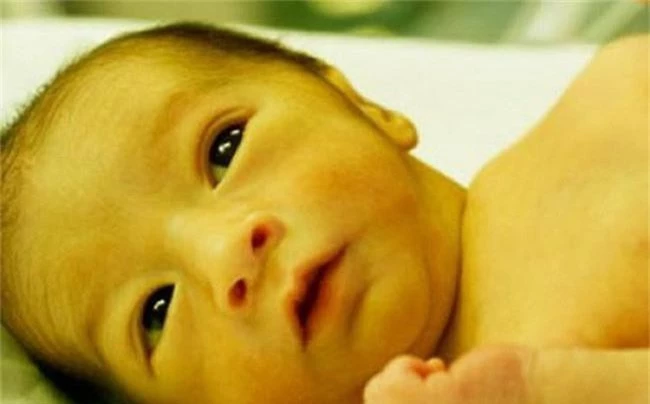 8 căn bệnh về da phổ biến trẻ sơ sinh nào cũng dễ mắc, các mẹ đang nuôi con nhỏ nên lưu ý - Ảnh 2.