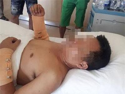 Thừa Thiên Huế: Khởi tố vụ nhóm côn đồ chém người đang nhậu trước quán cầm đồ