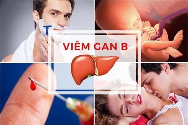 Hàng triệu người Việt tuột mất ước mơ vì nhiễm virus viêm gan B - Ảnh 6.