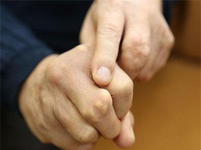 Chuyên gia chỉ cách kiểm tra sức khỏe thông qua những dấu hiệu bất thường ở bàn tay