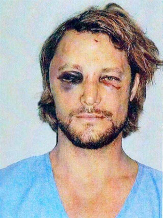 Những tai nạn khó quên của sao