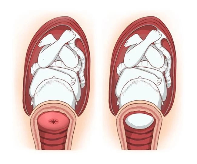 8 dấu hiệu cho thấy các mẹ chuẩn bị lâm bồn đến nơi rồi và những việc cấp thiết cần chuẩn bị ngay - Ảnh 8.