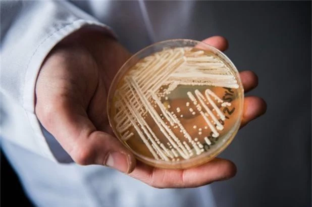 Dấu hiệu cảnh báo bạn có thể bị nhiễm siêu vi khuẩn nấm đang hoành hành trên toàn cầu và đe dọa tính mạng - Ảnh 1.