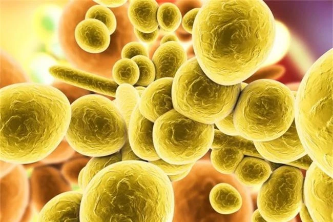Dấu hiệu cảnh báo bạn có thể bị nhiễm siêu vi khuẩn nấm đang hoành hành trên toàn cầu và đe dọa tính mạng - Ảnh 3.