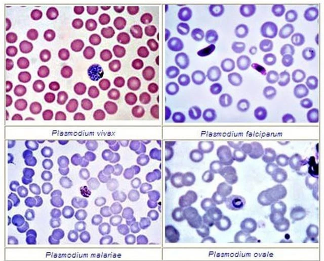 Xem kí sinh trùng sốt rét dùng “chiêu trò” để vô hiệu hóa hệ miễn dịch - 1