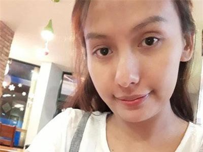 Sau nửa năm điều trị chứng xuất huyết não, bệnh tình của diễn viên Thúy Anh giờ ra sao?