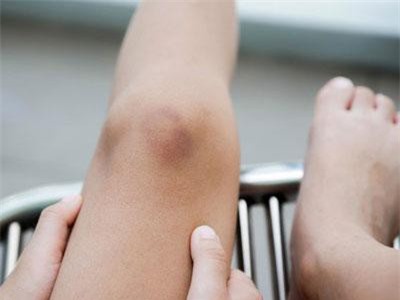 Trông thì rất bình thường nhưng đây lại là những dấu hiệu mà cơ thể đang "nhắc" bạn cần đi khám ngay