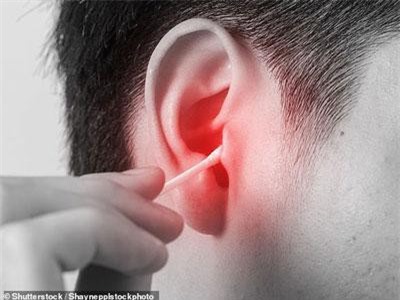 Áp-xe màng não do ngoáy tai bằng tăm bông