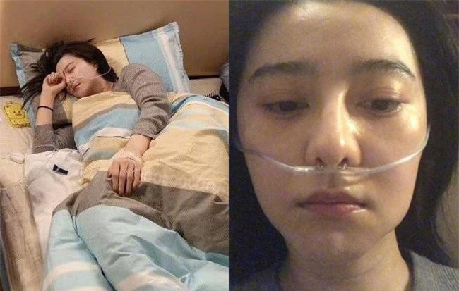 Phạm Băng Băng lâm bệnh nặng, chảy máu mũi phải truyền nước khi tới Tây Tạng làm từ thiện