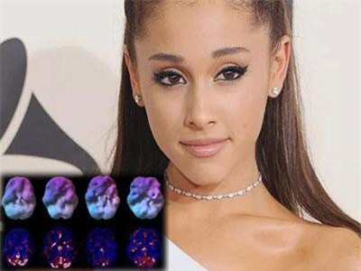 Nữ ca sĩ Ariana Grande chia sẻ bức ảnh "đáng sợ" về "căn bệnh" đã hủy hoại bộ não của cô