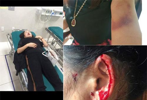 Vụ nữ giám đốc tố liên tục bị truy sát ở Quảng Bình: Công an thu giữ 4 viên đạn