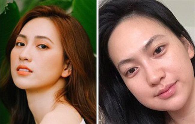 Phương Anh Đào bị nghi đụng chạm "dao kéo" vì mặt sưng khác lạ, nhưng nguyên nhân đằng sau khiến ai cũng bất ngờ!