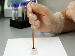 Phát minh thiết bị phát hiện vi khuẩn chỉ trong ít phút