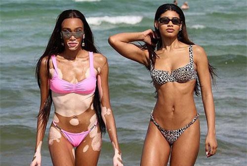 Winnie Harlow khoe dáng săn chắc và thanh mảnh