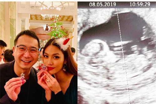 HOT: Chồng Lan Khuê khoe ảnh siêu âm thai nhi, chính thức xác nhận chuyện có em bé