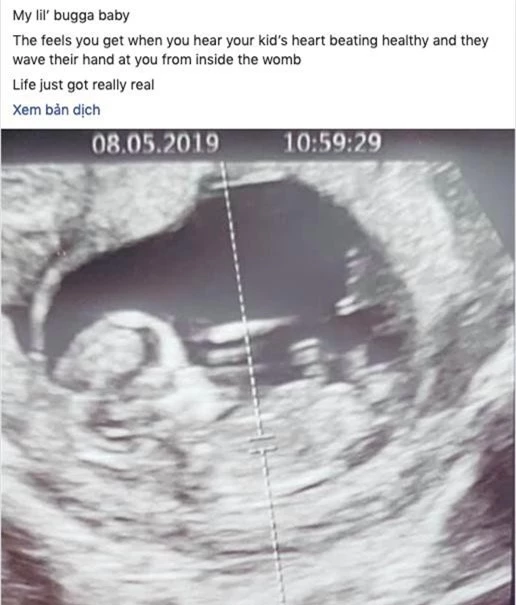 HOT: Chồng Lan Khuê khoe ảnh siêu âm thai nhi, chính thức xác nhận chuyện có em bé - Ảnh 1.
