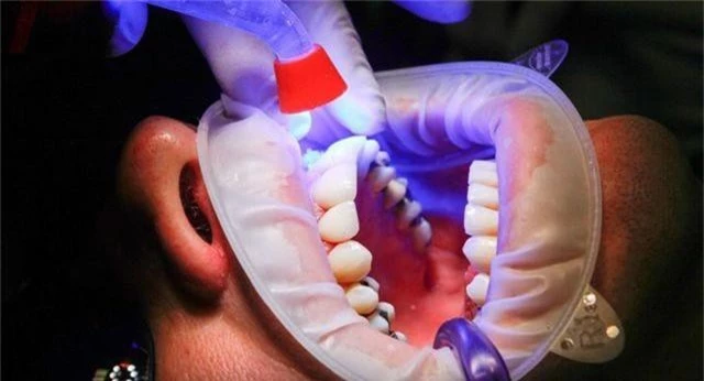 Có nên súc miệng sau khi đánh răng? - 1
