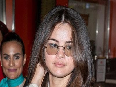 Selena Gomez gây sốc khi xuất hiện với gương mặt sưng phù, bóng dầu và sần sùi mụn