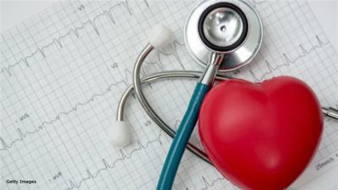 Bệnh lý tim mạch là nguyên nhân gây tử vong số 1 ở Mỹ.