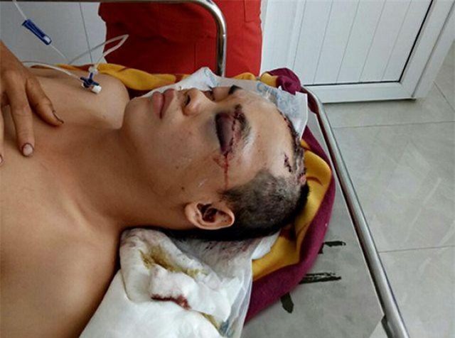 Phú Yên: Nghi can chém người, cướp của bị tóm gọn khi đang chuẩn bị vượt biên