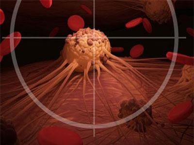 Khoa học chỉ ra yếu tố làm tăng nguy cơ ung thư