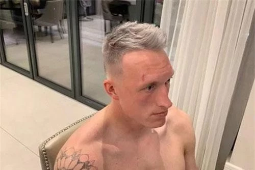 Kiểu tóc mới của Phil Jones.