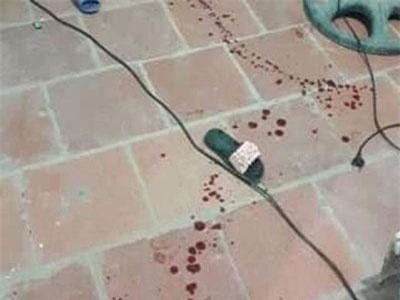 Thanh Hóa: Bé gái 10 tuổi nghi bị nam thanh niên chém nhiều nhát ngay tại nhà