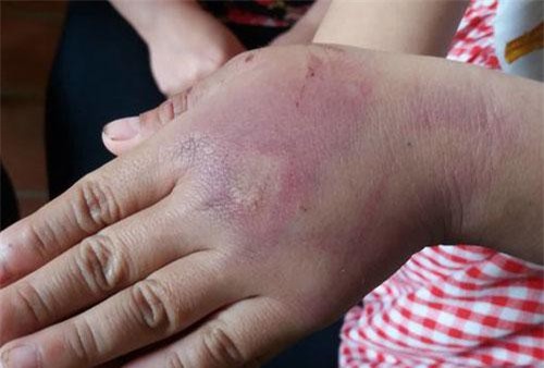 Thanh Hóa: Phạt 2,5 triệu đồng người bố hành hung con gái