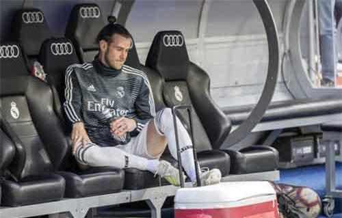 Bale: Chúng tôi như những con robot, mất hết tự do