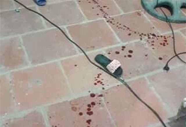 Vụ bé gái 11 tuổi bị chém trọng thương ở Thanh Hóa: Nghi can từng hành hung mẹ nạn nhân