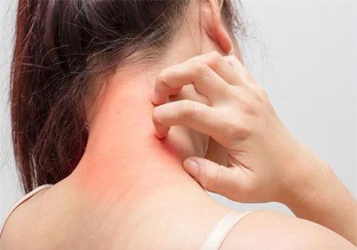 Biến đổi khí hậu có thể làm cho bệnh dị ứng theo mùa tồi tệ hơn