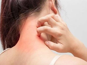 Biến đổi khí hậu có thể làm cho bệnh dị ứng theo mùa tồi tệ hơn