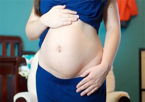 Sau sinh mổ, mẹ nhớ lưu ý 7 cách này để nhanh chóng hồi phục sức khỏe và bước vào “cuộc chiến” chăm con